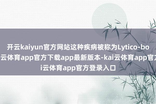 开云kaiyun官方网站这种疾病被称为Lytico-bodig病-kai云体育app官方下载app最新版本-kai云体育app官方登录入口